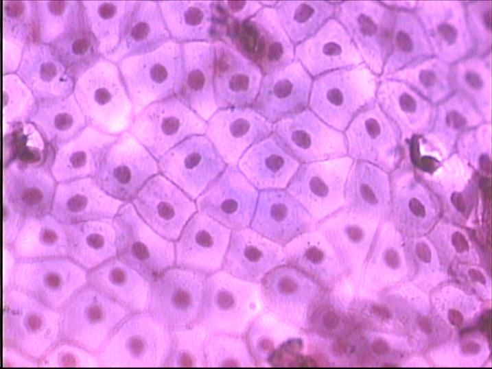 Simple Squamous Epithelia - frog skin surface view | Squamous ...